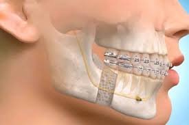 Oral Surgery Procedure